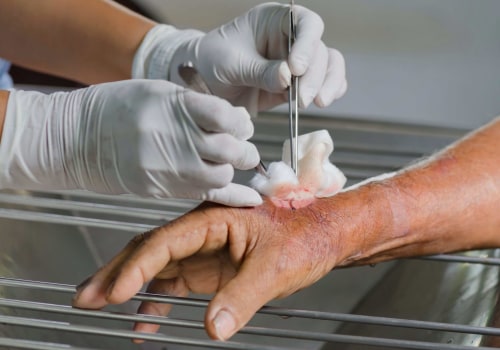 The Importance of Debridement in Wound Care